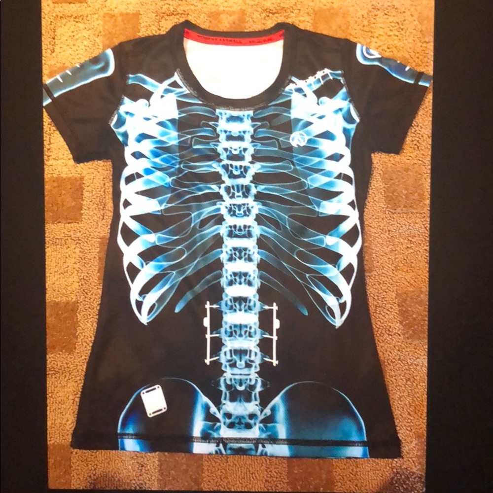 Inknburn blue X-ray tech